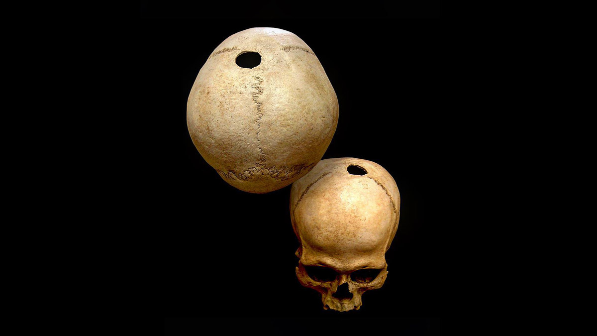 Il Cranio trapanato di Su Crucifissu Mannu (foto de L'Ibis servizi culturali e turistici - Porto Torres)