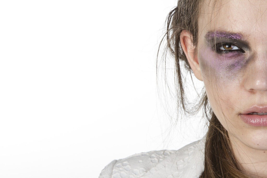 Donna violenza. ? Engin Akyurt | Pixabay