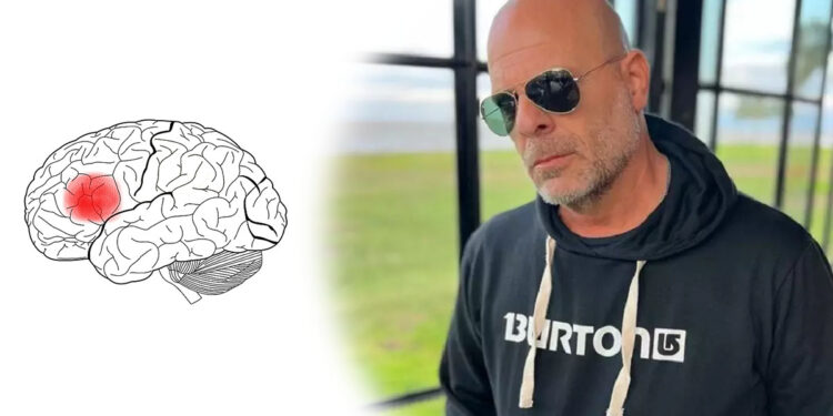 Bruce Willis - Afasia