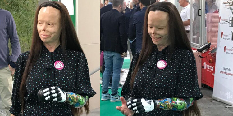 La protesi Nexus di Valentina Pitzalis