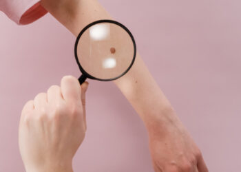 Controllo nei. ? Pexels