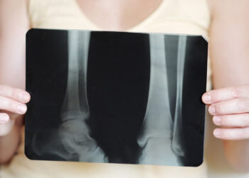 Radiografia. ? Depositphotos