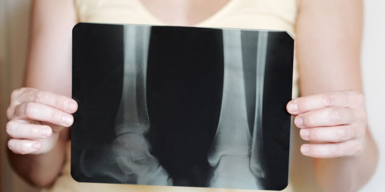 Radiografia. ? Depositphotos