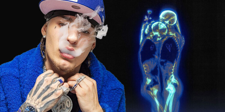 Rondodasosa - “Chiara”