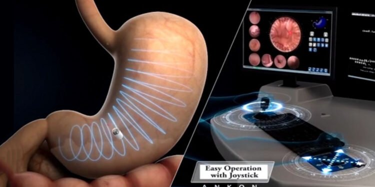 Videocapsula gastroscopia NaviCam Stomach System