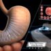 Videocapsula gastroscopia NaviCam Stomach System