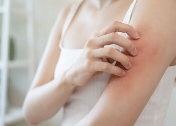 Prurito malattia della pelle. ? Depositphotos