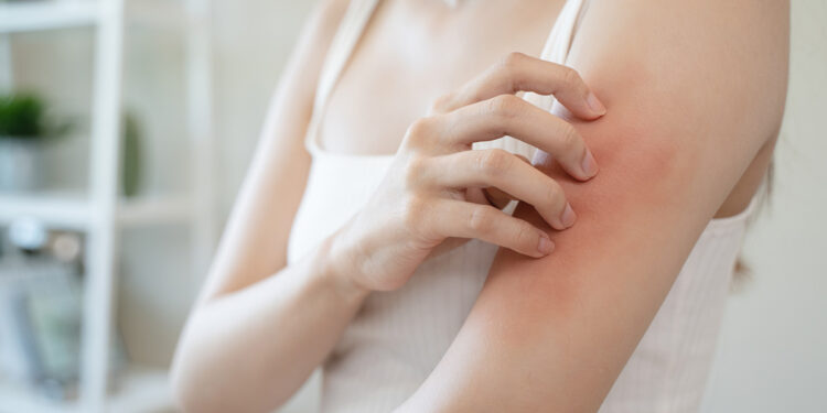 Prurito malattia della pelle. ? Depositphotos