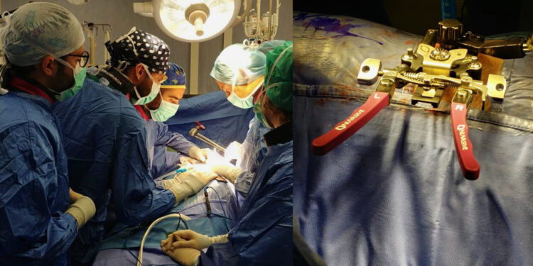 Neurochirurgia di Sassari - Tecnica XLIF cura mal di schiena cronico