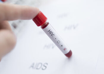HIV AIDS test screening. 📷 Depositphotos