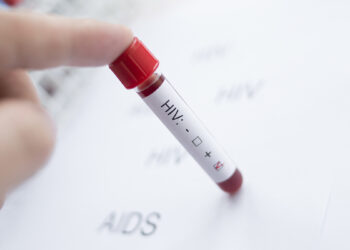 HIV AIDS test screening. ? Depositphotos