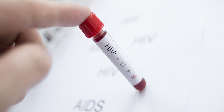 HIV AIDS test screening. ? Depositphotos