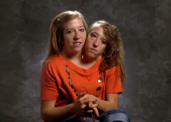 Le gemelle siamesi Abby e Brittany Hensel
