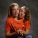 Le gemelle siamesi Abby e Brittany Hensel